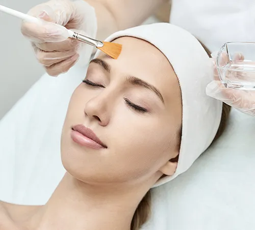 Carbon peel for a fair skin